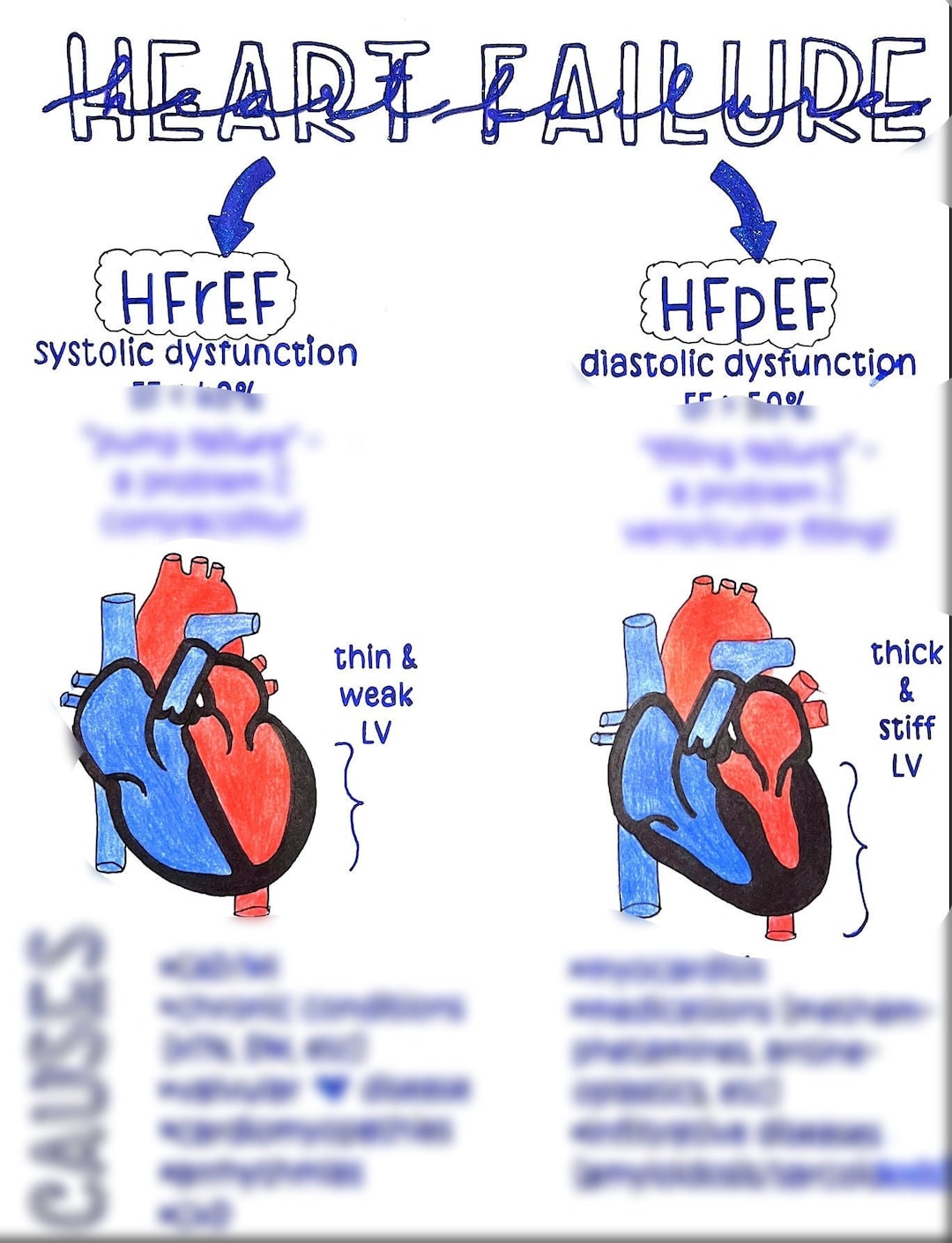 Hfref Vs Hfpef
