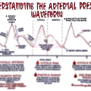 The Arterial Line (ABP) Waveform
