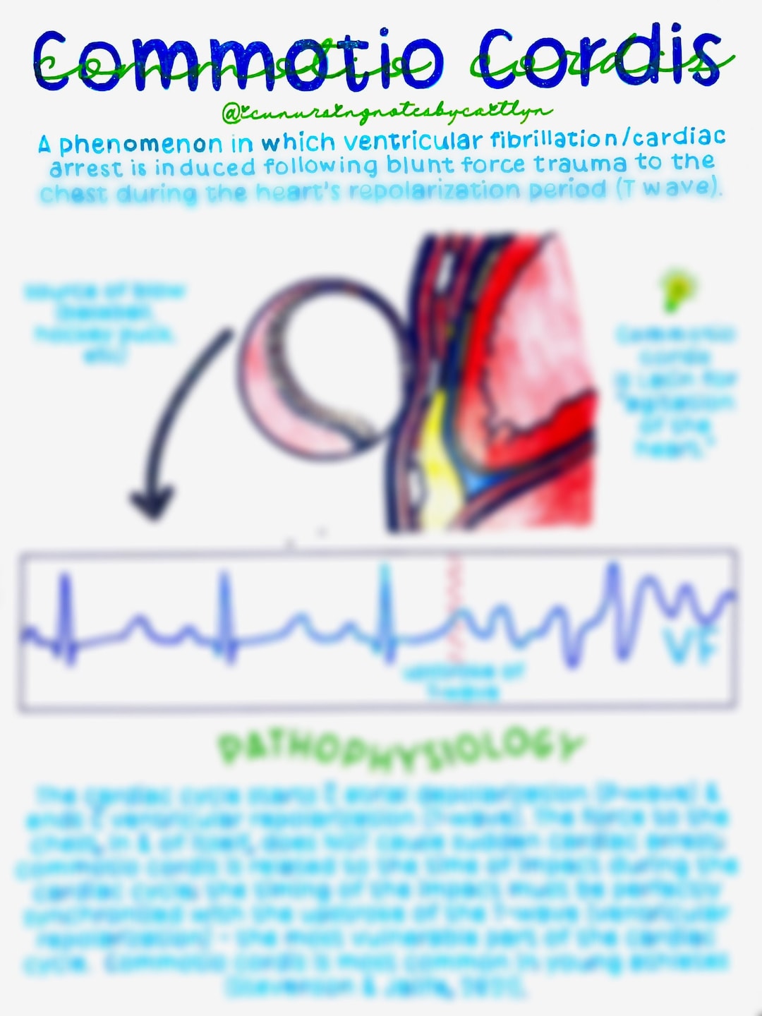 Commotio Cordis Etsy
