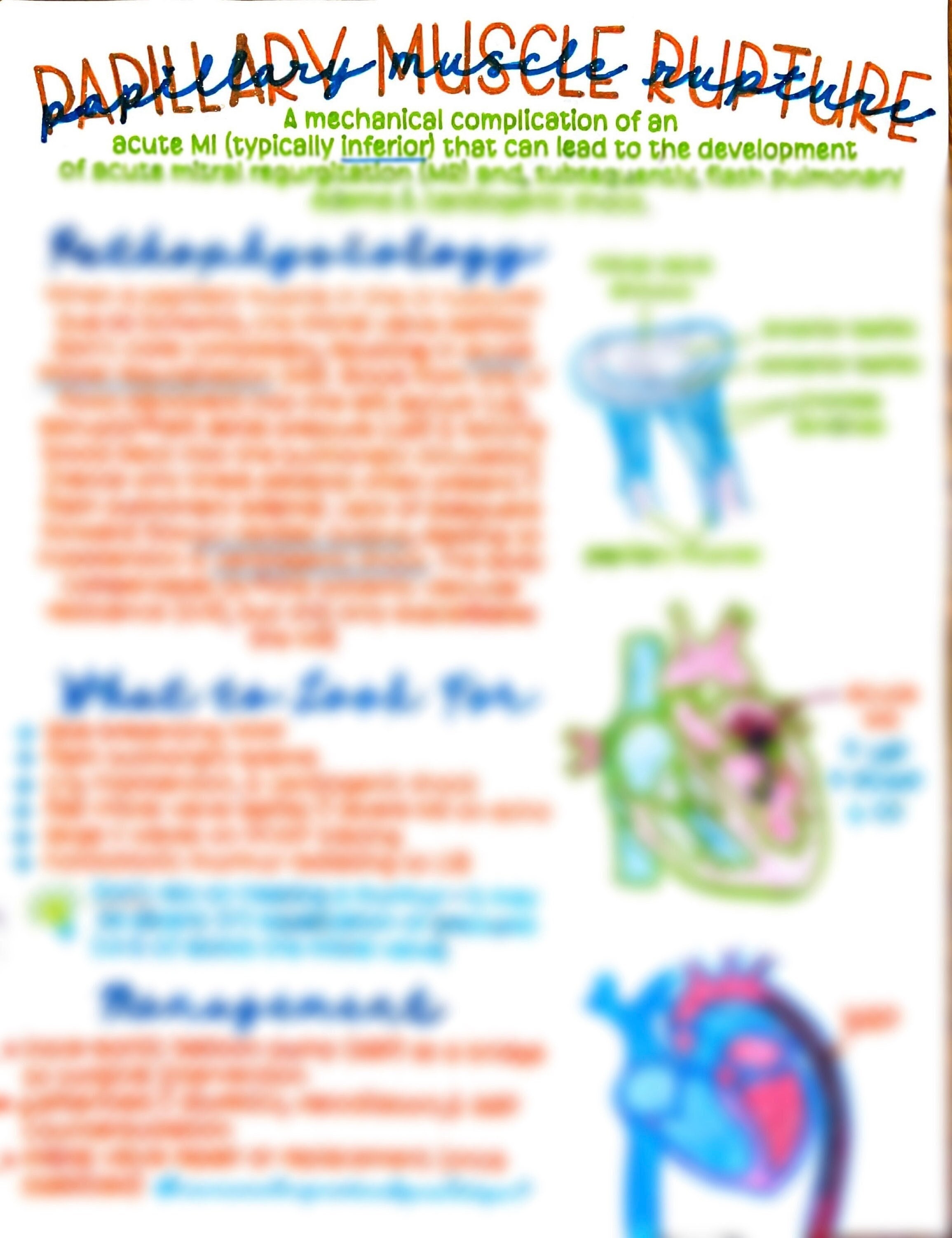 Papillary Muscle Rupture - Etsy
