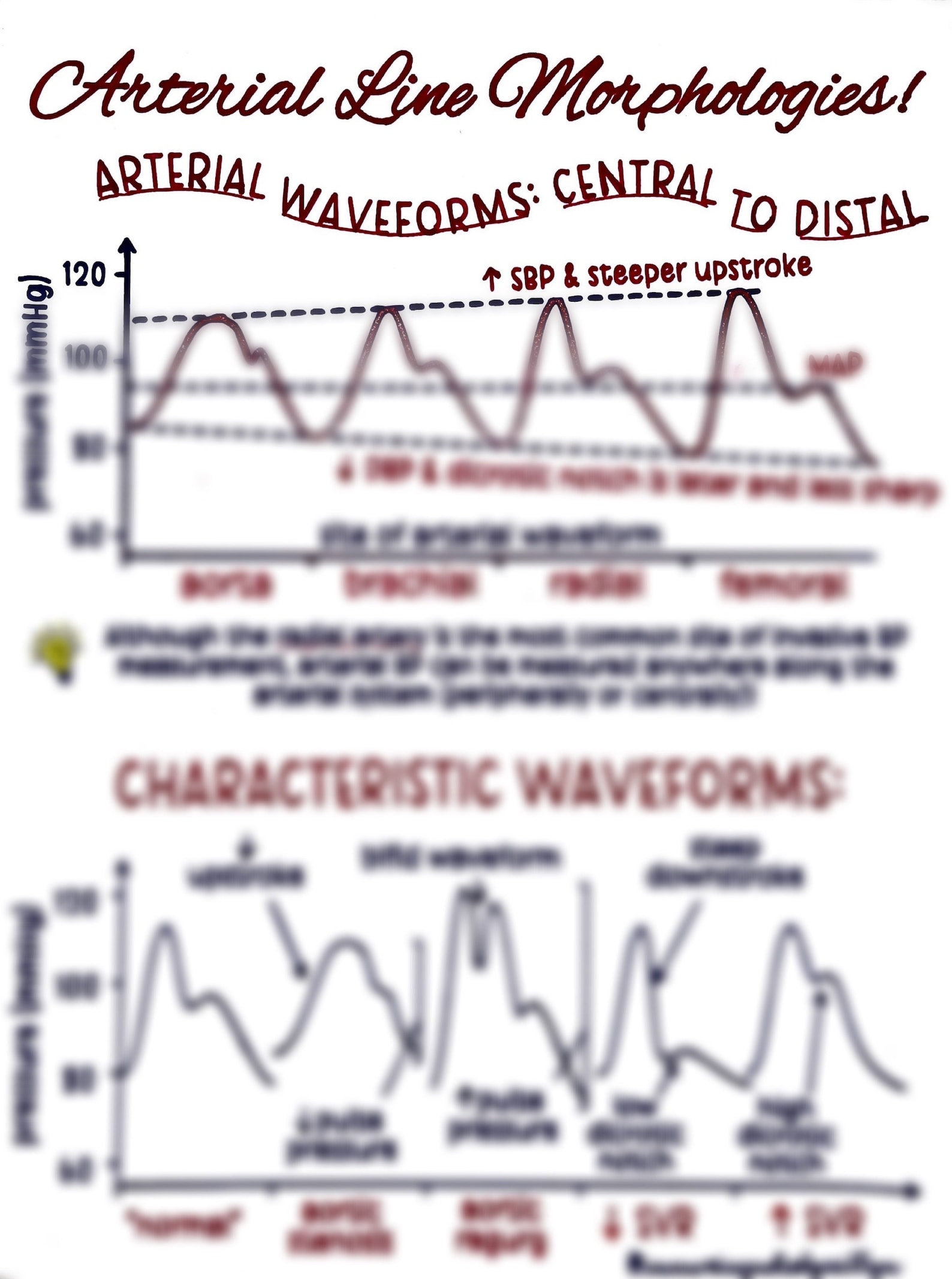 The Arterial Line ABP Waveform Etsy