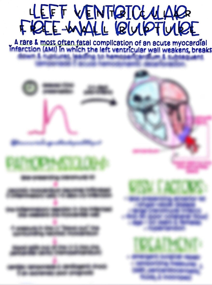 Left Ventricular Free Wall Rupture LVFWR Etsy Left Ventricular Free Wall Rupture LVFWR Etsy
