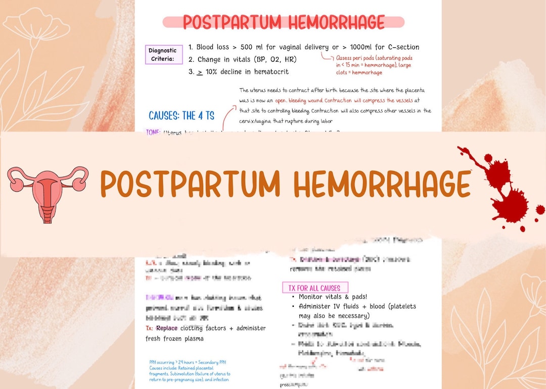 Postpartum Hemorrhage NCLEX Review Nursing Notes Etsy Ireland