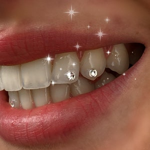 Puede incluir: Primer plano de una boca sonriente con dientes blancos brillantes. Varios dientes están adornados con pequeños pedrería brillantes. Los labios son de color rojo intenso y la imagen tiene un efecto suave y brillante.