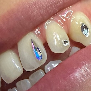 2x Raindrop Kristalle (Swarovski) für Tooth Gems
