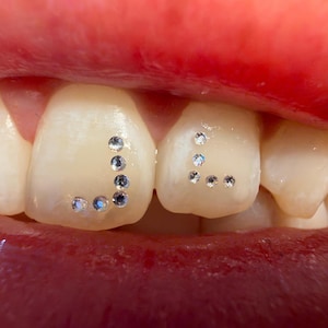 Peut inclure: Deux dents humaines ornées de petits strass dentaires circulaires et transparents disposés selon des motifs distincts. La dent de gauche présente une ligne verticale de strass incurvée, tandis que la dent de droite montre un motif angulaire.