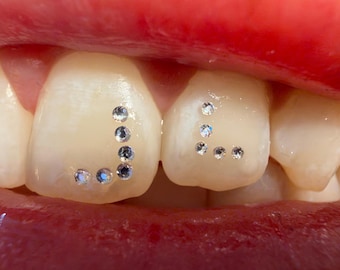 Smallest crystals: 1 mm and 0.8 mm • Baby Gems • Micro Gems || Ideal for creative tooth gem sets