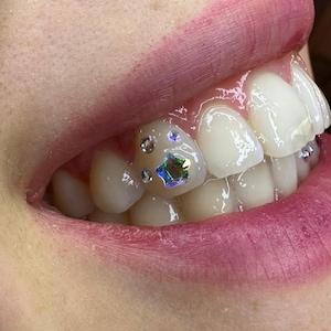 Flower | Star Flower Crystal • Tooth Gem (Swarovski) - various colors