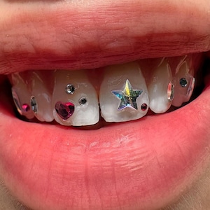 Rivoli Star (Swarovski) for Tooth Gems