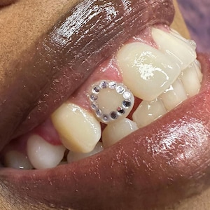 50x -100x mini 1.4 mm Tooth Gems • ideal for creative sets