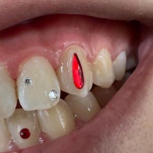 2x Raindrop Crystals (Swarovski) for Tooth Gems