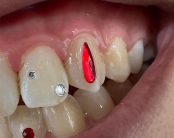 2x Raindrop Crystals (Swarovski) for Tooth Gems