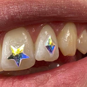 Diamond Form Crystals (Swarovski) - various colors for Tooth Gems image 4