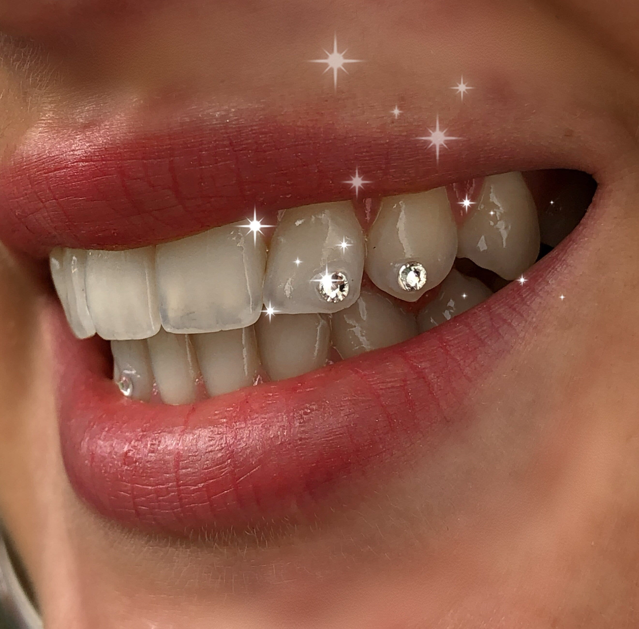 Inspired by Louis Vuitton (LV) – Swarovski Tooth Crystals & Tooth