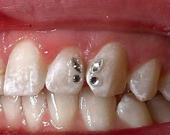 Set di micro/piccole farfalle • Gemme per denti/gioielli per denti