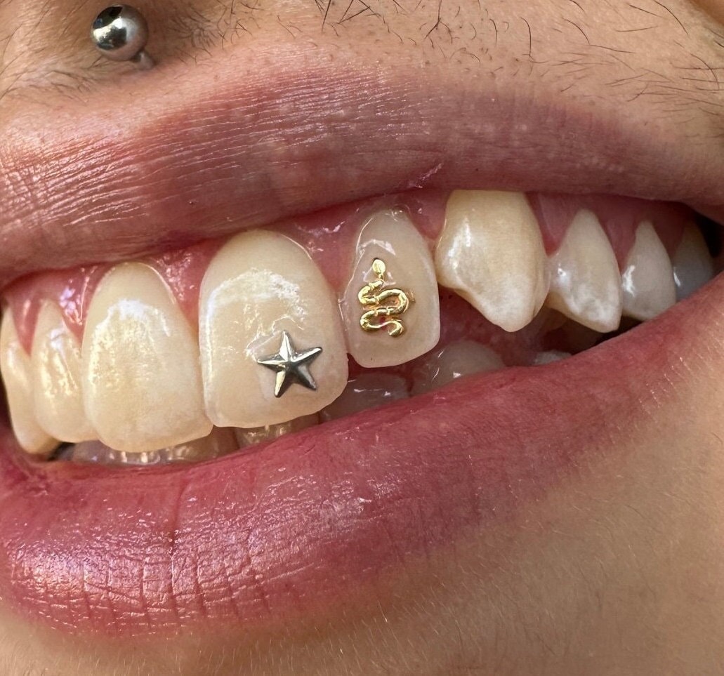 Custom Dental Jewelry Teeth Gem 18K Solid Gold Tooth Gems