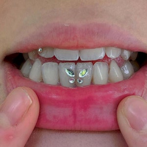 Houston Tooth Gems — Battle Royale Tattoo