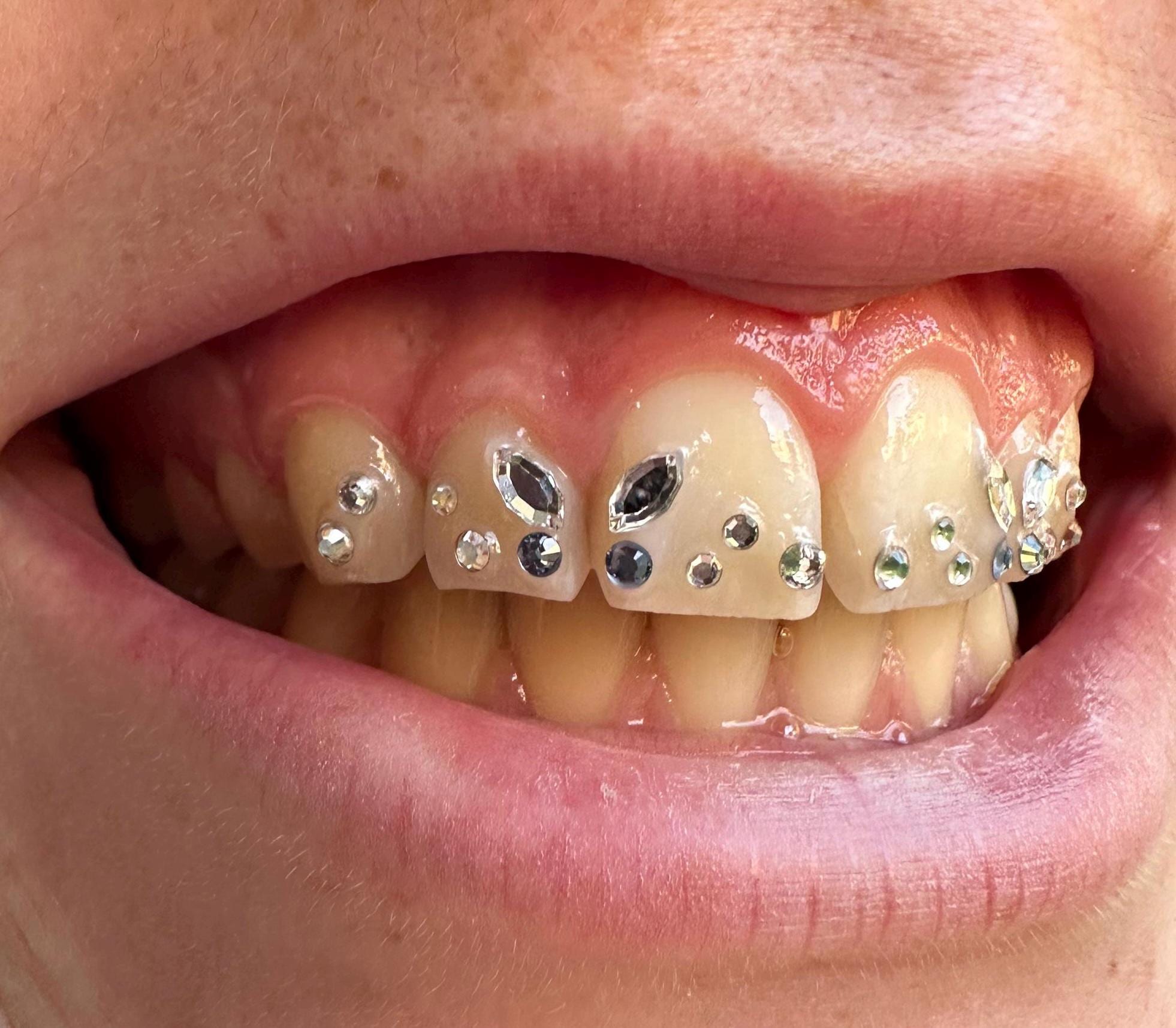 Navette Crystal (swarovski) Butterfly Set *tooth Gem* - Etsy