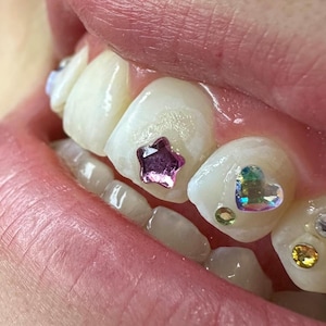 Flower • Tooth Gem (Swarovski) - various colors