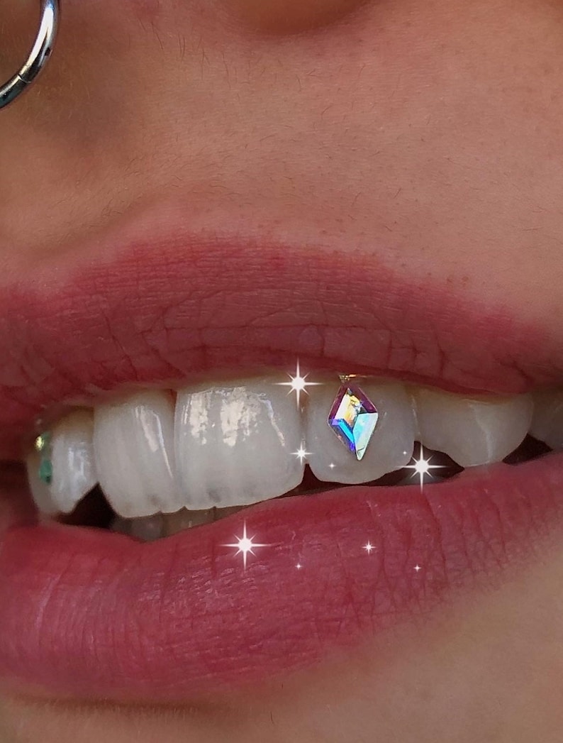 May include: Close-up of a person's smile with a single iridescent diamond tooth gem on a front tooth.