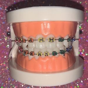 Può includere: Un modello dentale con una serie completa di denti bianchi, che mostra apparecchi ortodontici colorati. Gli apparecchi presentano staffe di vari colori, tra cui rosso, arancione, giallo, verde e blu, fissate a un filo d'argento.