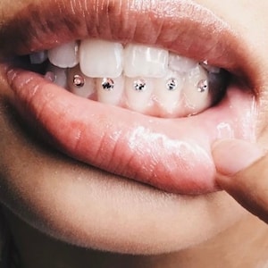 Classic DIY tooth gem kit