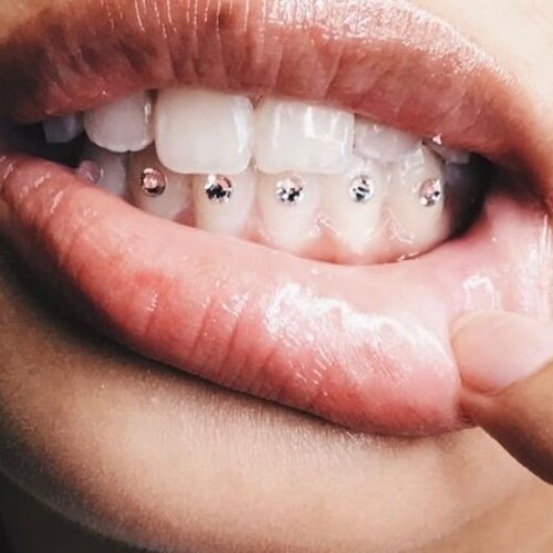 Classic DIY Tooth Gem Kit Etsy