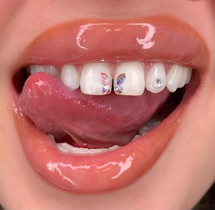 Tooth Gems – Philadelphia, PA - Halo Ali Teeth Whitening