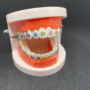 Fake Braces w adhesive-LONGER LASTING-w adhesive
