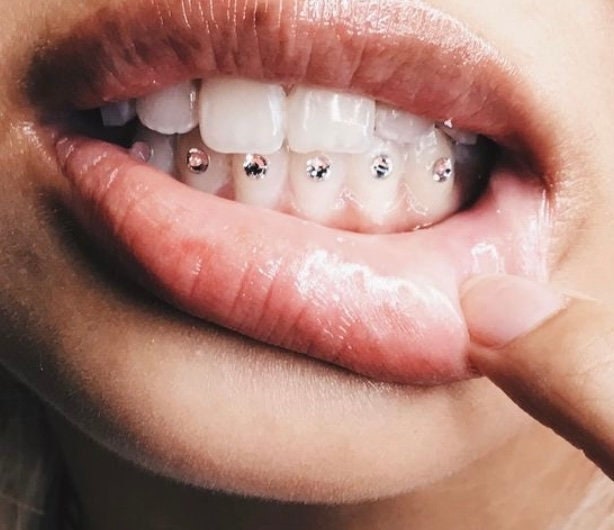 Classic DIY tooth gem kit
