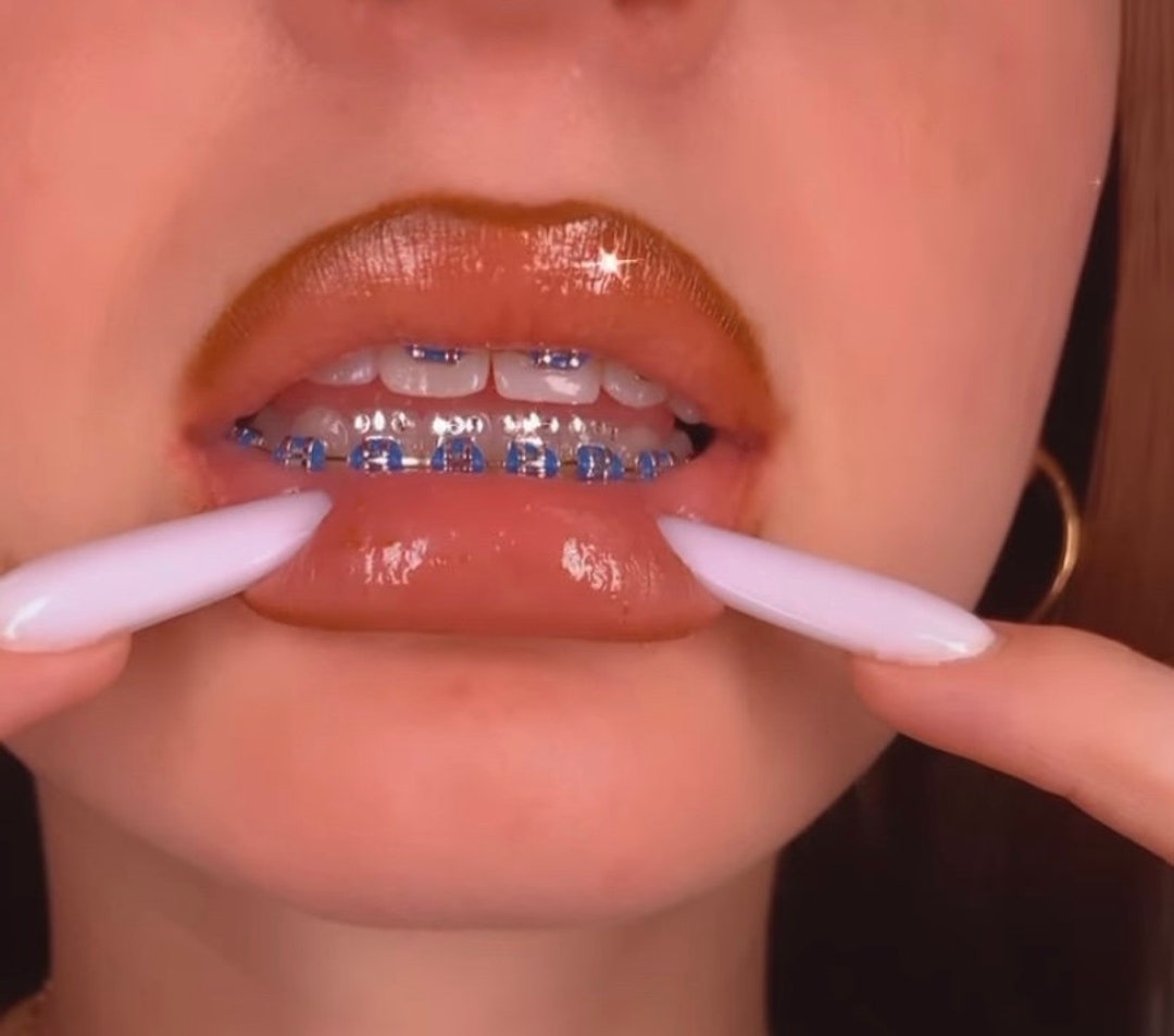 Juego de gemas dentales fáciles de quitar, joyería Dental blanca