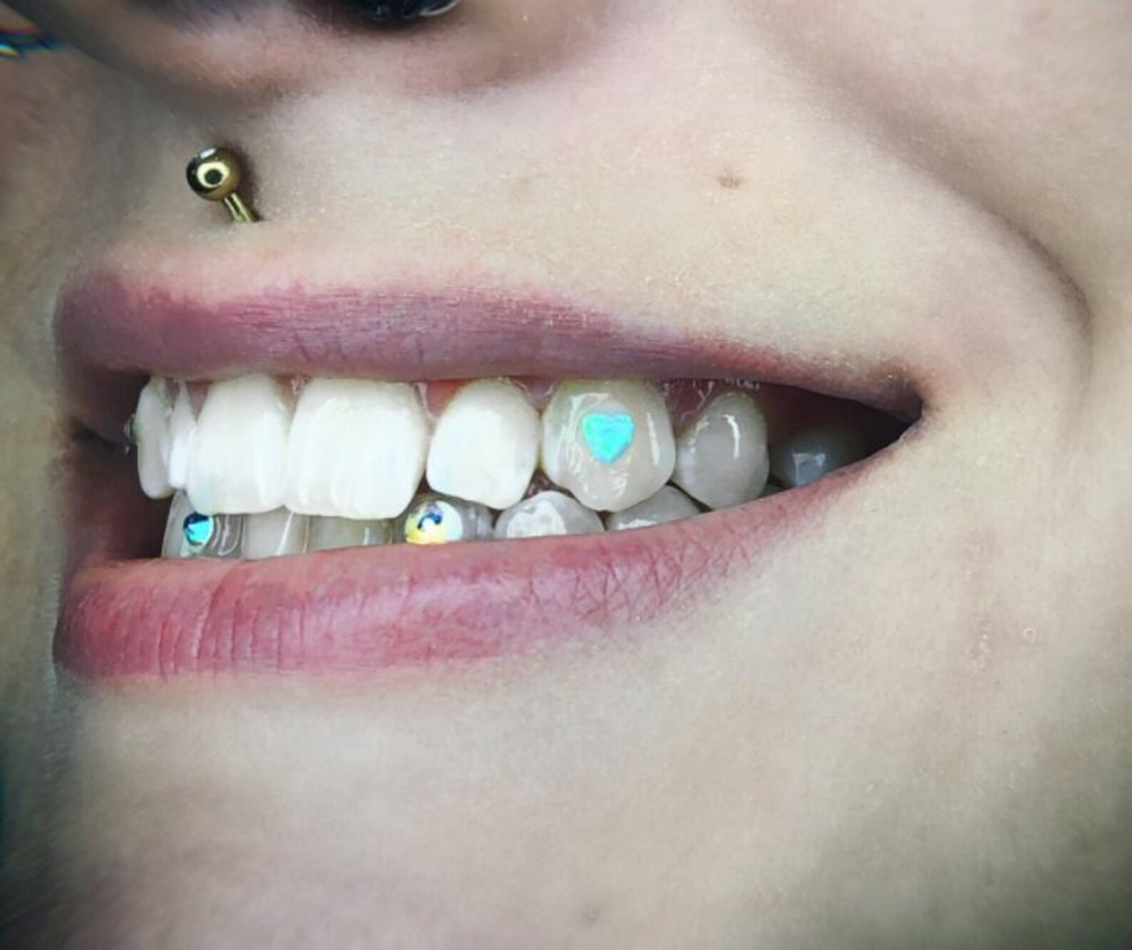 Opal Tooth Gem Kit Etsy