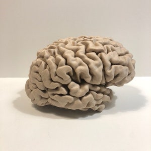 Your brain 3D printed from MRI files