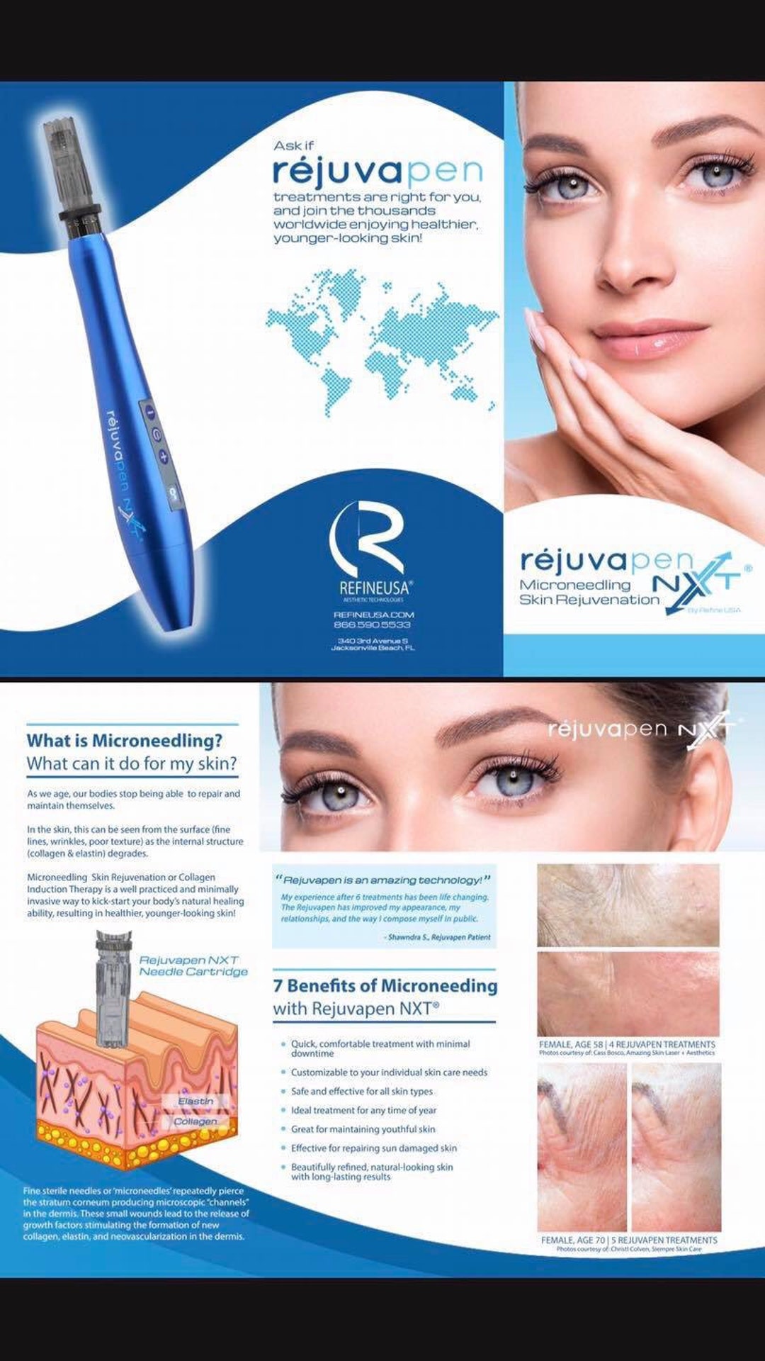 Rejuvapen Microneedling Device Etsy