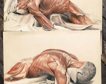 Cadaver Chalk Drawings Restored Reproduction Prints