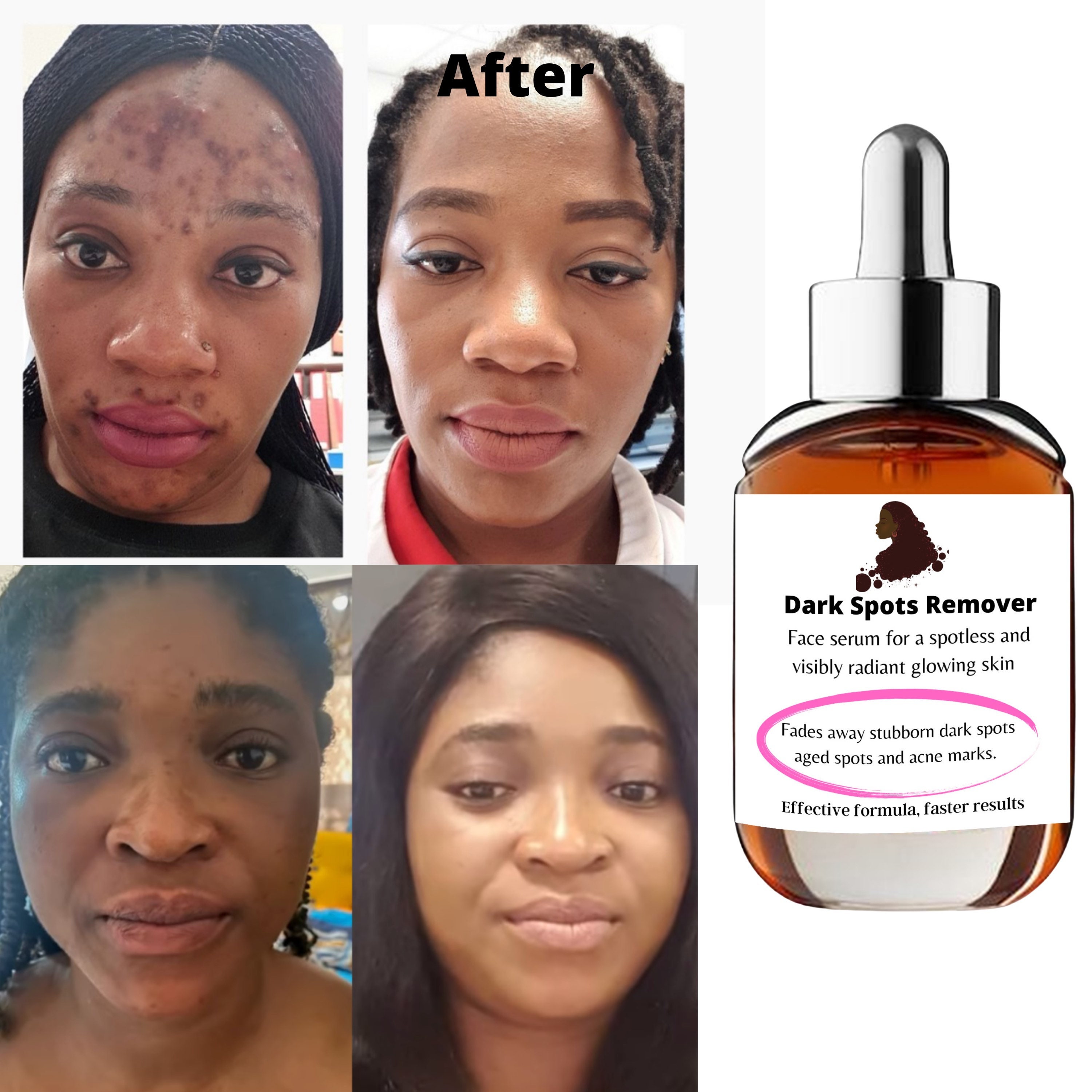 Dark Spot Remover Aged Spots Perfect Glowing Skin