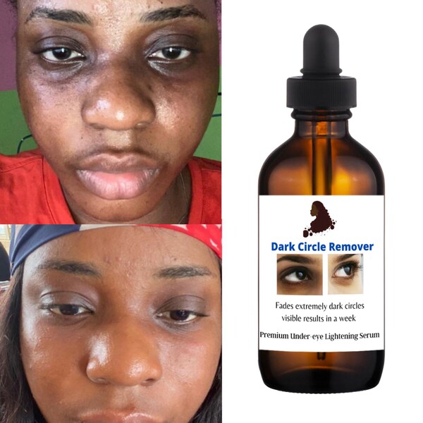 Eye Serum Etsy