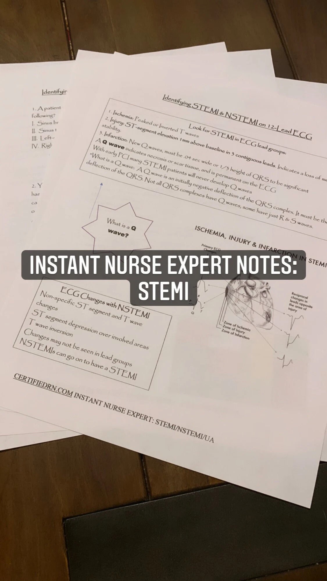 Cardiac Bundle: 2 12-lead ECG Overlays and 4 Instant Nurse Expert ...