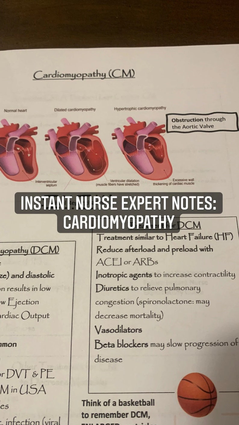 Cardiac Bundle: 2 12-lead ECG Overlays and 4 Instant Nurse Expert ...