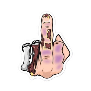 May include: A cartoon illustration of a middle finger with exposed bone and muscle. The finger is raised in a rude gesture. The skin is a pale pink color with purple bruising. The bone is white and the muscle is a reddish brown color.