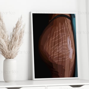 May include: A digital illustration of a person's back with white lines drawn on the skin. The background is a dark blue color.