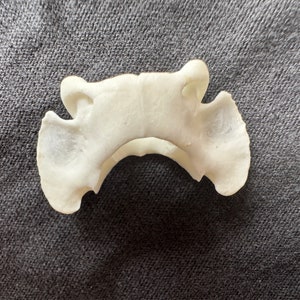 Pode incluir: Um modelo anat&ocirc;mico branco de uma v&eacute;rtebra humana, mostrando a estrutura &oacute;ssea e o canal espinhal.