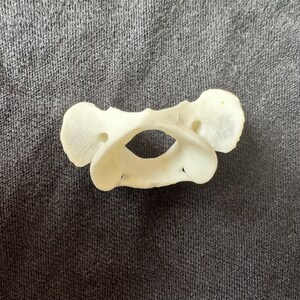 Pode incluir: Um modelo anat&ocirc;mico branco de uma v&eacute;rtebra humana, provavelmente da coluna lombar, com um furo no centro e dois pequenos furos de cada lado.