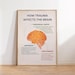 How Trauma Affects the Brain, Trauma Brain Poster, Mental Health Wall ...