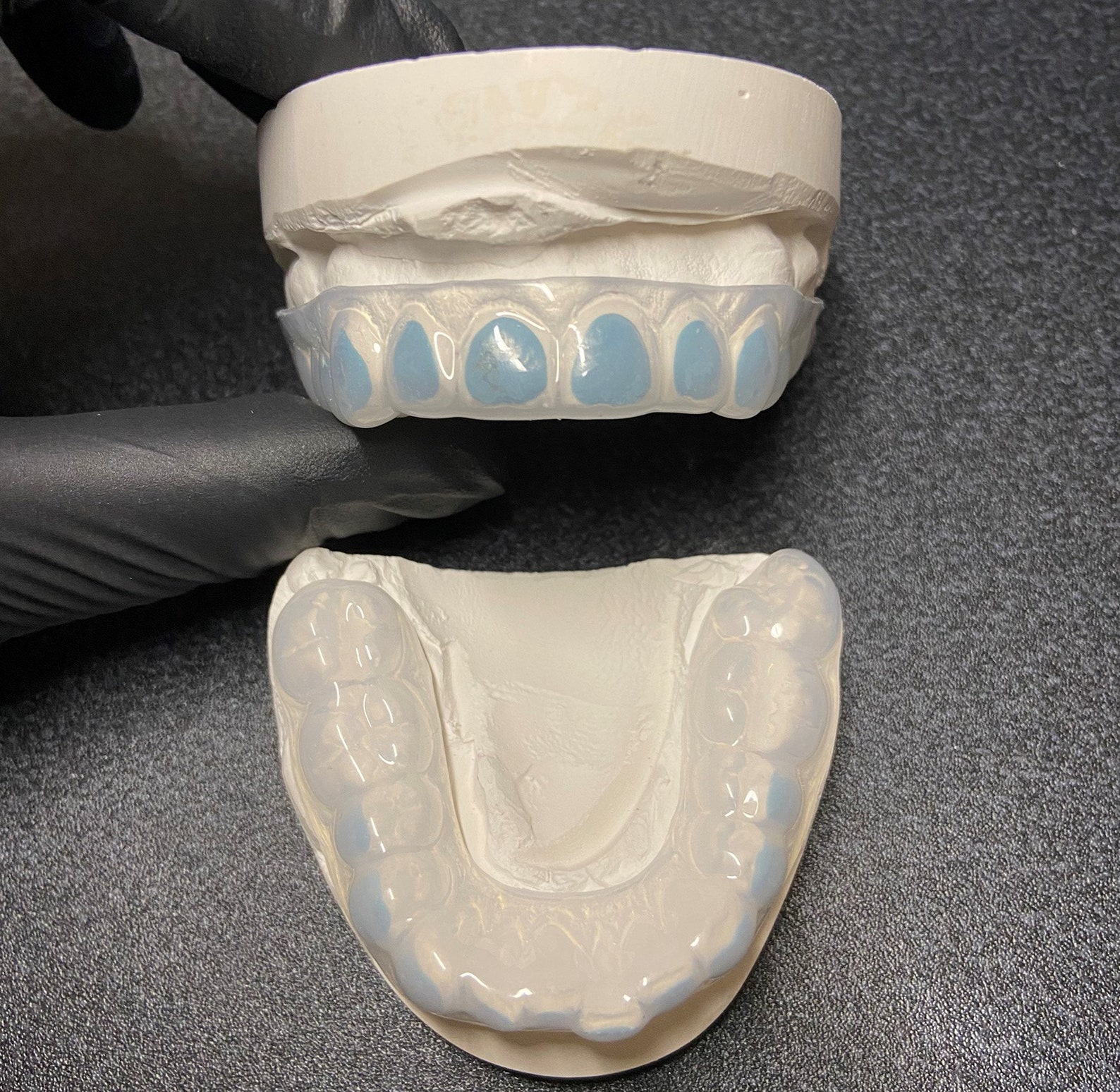 Custom Fit Teeth Whitening Bleaching Trays With Dental Reservoirs Hard and Soft Etsy UK