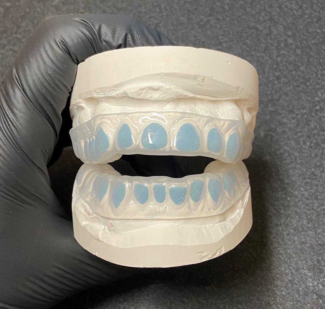 Custom Fit Teeth Whitening Bleaching Trays With Dental Reservoirs Hard