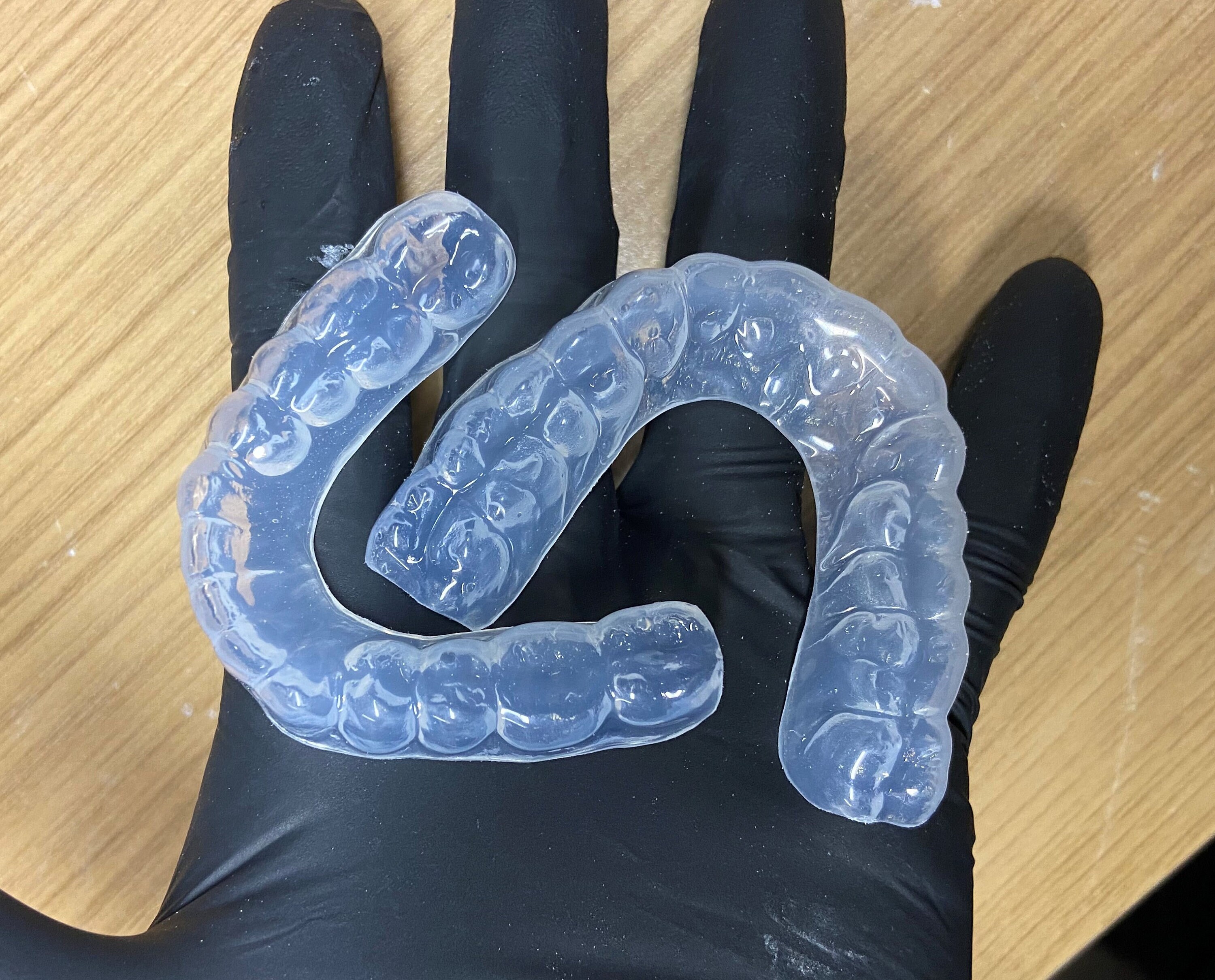 Custom Dental Standard Teeth Whitening/bleaching Trays 2mm Etsy UK