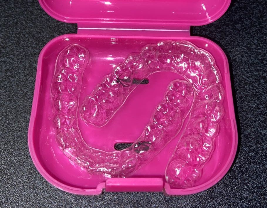 Custom Fit Dental Orthodontic Essix Retainer UPPERLOWER Etsy UK