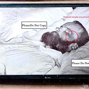 May include: Black and white photograph of a man lying down, with a beard and a visible wound on his temple. The image is framed within a black border, with text that reads "Dressed temple wound exit" and "Please Do Not Copy".