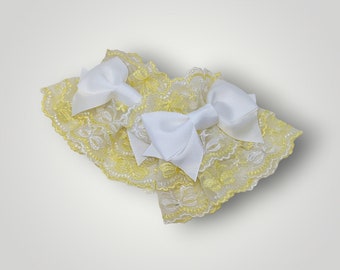 Yellow and White Bow Lace Wrist Cuffs